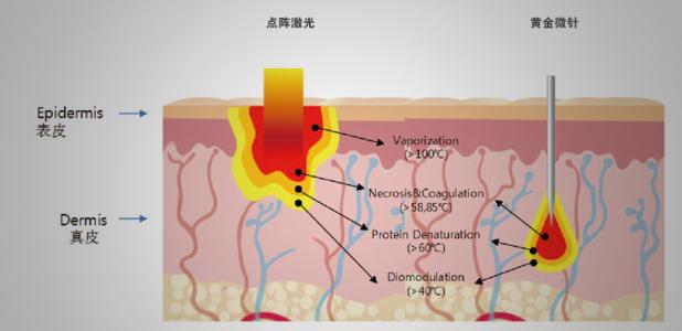 上海做假体丰胸整形手术可靠吗