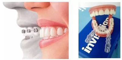 上海做假体丰胸整形手术可靠吗