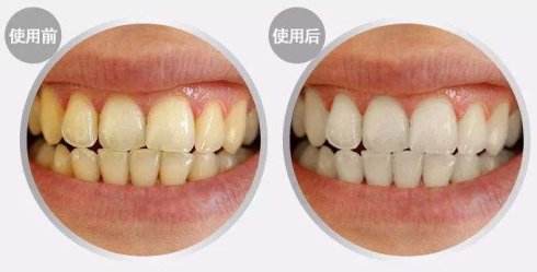 隆鼻整形术后什么时候可以化妆啊