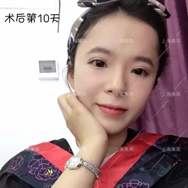 美莱隆重举办西班牙皇后脂雕新品发布