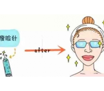 上海做激光去色斑大概多少钱