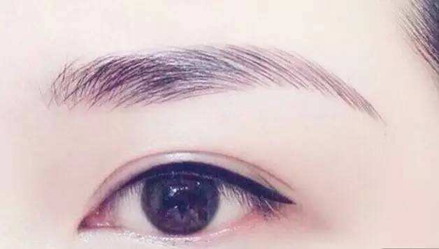 美莱祛斑新技术CNT全面上市