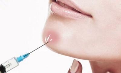 做进行一次激光脱毛需要多少钱呢