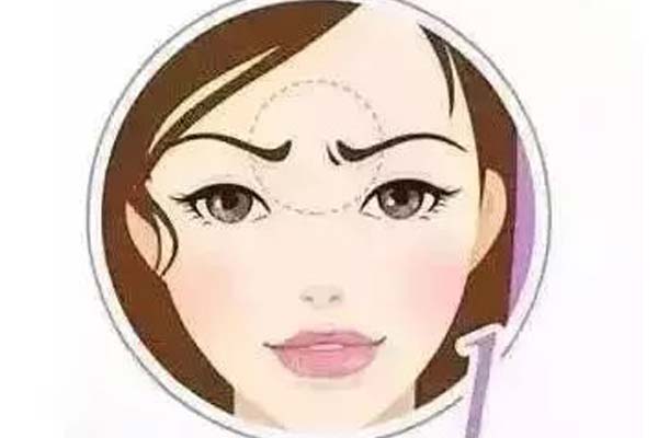 隆鼻整形术后效果能保持多长时间