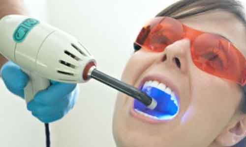 美莱隆胸整形真人案例，安凝参加美胸年度盛典