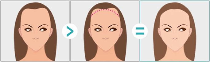 上海做韩式隆鼻会不会有后遗症