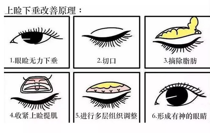 上海哪个医院做腿部吸脂效果好