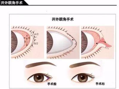 美莱专家出席“美斯蒂克”吸脂塑形减肥疗法大会