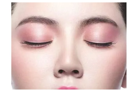 上海做激光祛痘坑一次有效吗