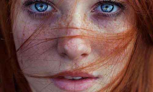 美莱“皮秒激光去黄褐斑”论坛会成功举办