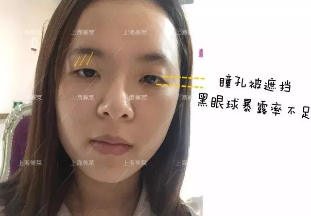 美莱“皮秒激光去黄褐斑”论坛会成功举办