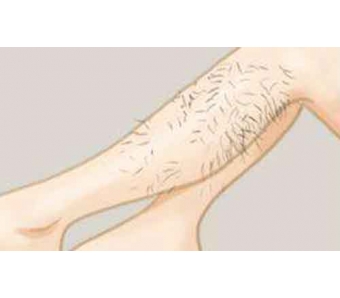 隆鼻整形的方法有那几种