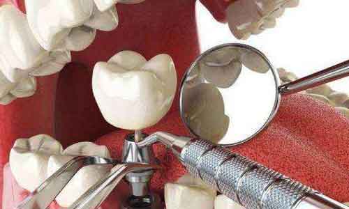 美莱医院分享乔雅登玻尿酸案例