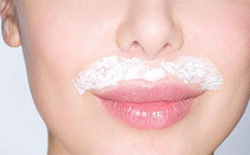 美莱医院分享乔雅登玻尿酸案例