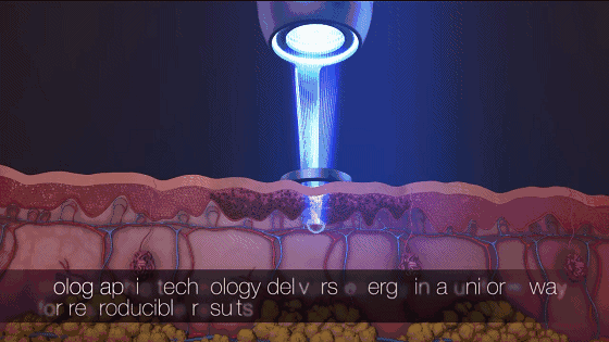 上海玻尿酸隆鼻需要打多少支玻尿酸