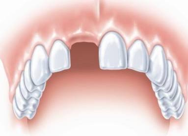 上海做吸脂减肥手术会不会有副作用