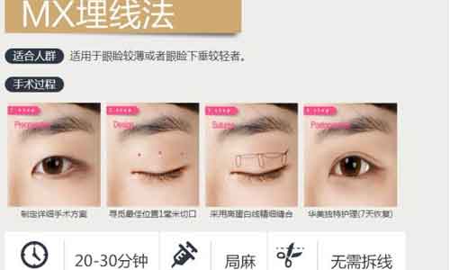 法国CYTOCARE丝丽动能素中除皱论坛会美莱举办