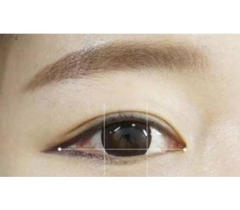 手臂吸脂术后皮肤会不会出现凹凸不平的情况