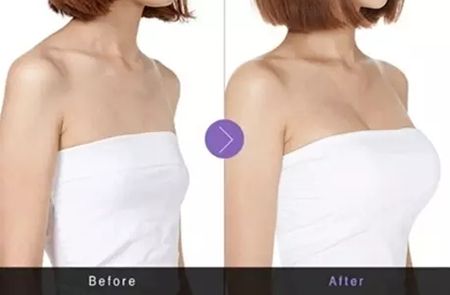 激光祛斑后要注意些什么