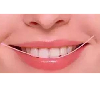 上海美莱邀你来领圣诞礼物啦