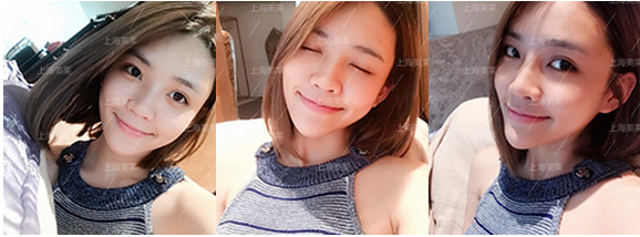 肚子上有很多赘肉怎么才能瘦掉