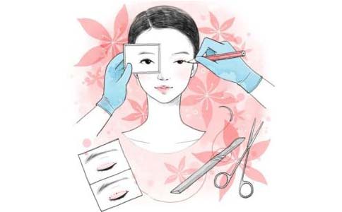 上海做激光祛斑会不会留疤啊