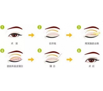 美莱举办“新美莱·馨绽放·心关怀”活动