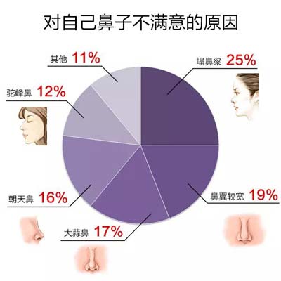 假体隆鼻多年后需要取出假体吗