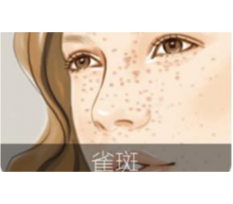 上海注射瘦腿针后多久可以运动