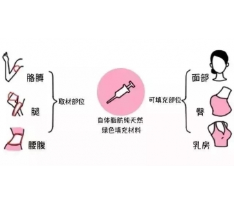 发际线上移怎么改善,上海美莱植发来帮你