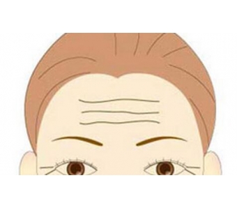 上海打了玻尿酸会不会有什么后遗症呢