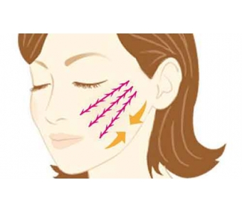 在上海做双眼皮手术安全吗