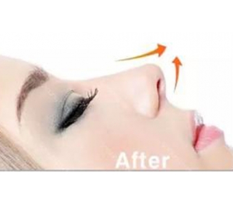 上海做了去眼袋手术会不会留下疤痕