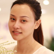 怎么才能快速有效的去掉脸上的雀斑