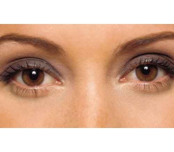 上海做激光去痘痘要多少钱呢