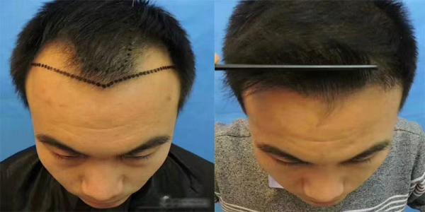 有什么方法可以又快又好的丰胸