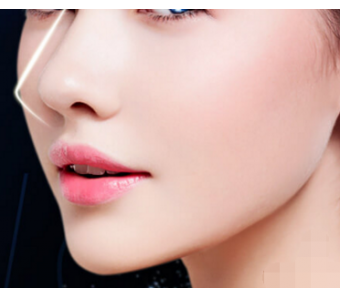 面部线雕除皱失败了还能修复吗