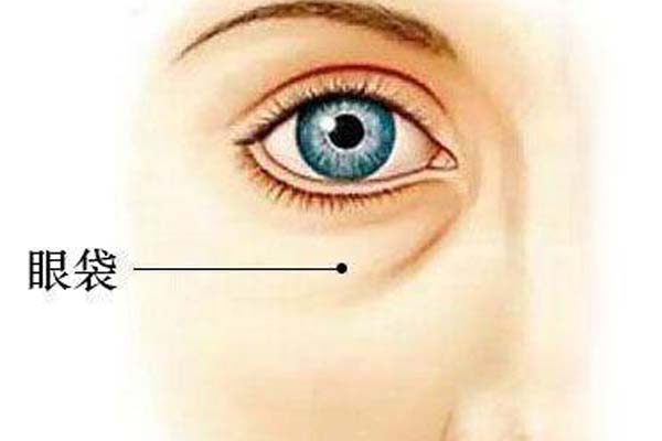 面部线雕除皱失败了还能修复吗