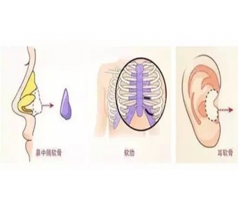面部线雕除皱失败了还能修复吗