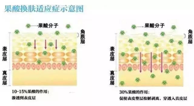 上海做吸脂减肥会不会有什么副作用