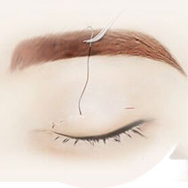 上海美莱医疗美容