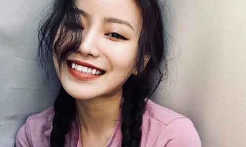 上海韩式双眼皮多久能消肿,多久会恢复自然