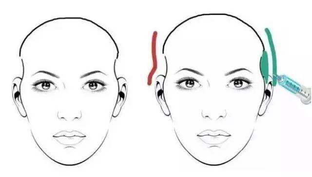 上海韩式双眼皮多久能消肿,多久会恢复自然