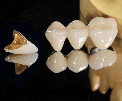 上海假体垫下巴几天拆线,恢复时间需要多久