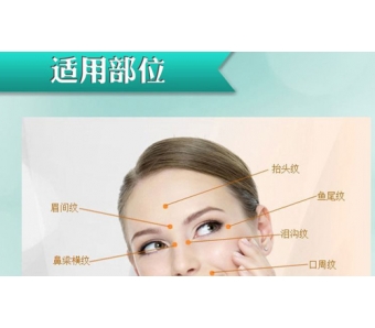 上海注射除皱效果好吗,效果可以维持多久