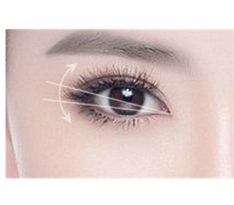 上海玻尿酸丰唇价格是多少,会很贵吗