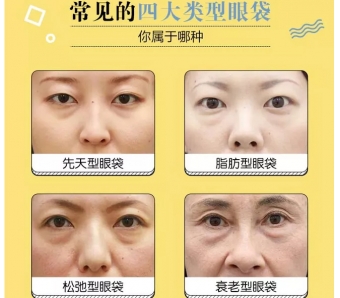 上海隆假体下巴后短期可以进行化妆吗,会有什么影响