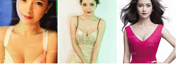 上海隆鼻三年为何假体出现反应,出现感染怎么办