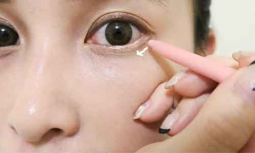 注射隆鼻的效果如何,上海哪些人不适合注射隆鼻