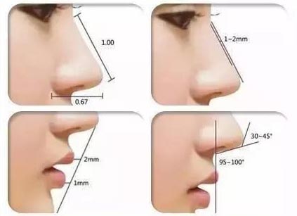 注射隆鼻的效果如何,上海哪些人不适合注射隆鼻